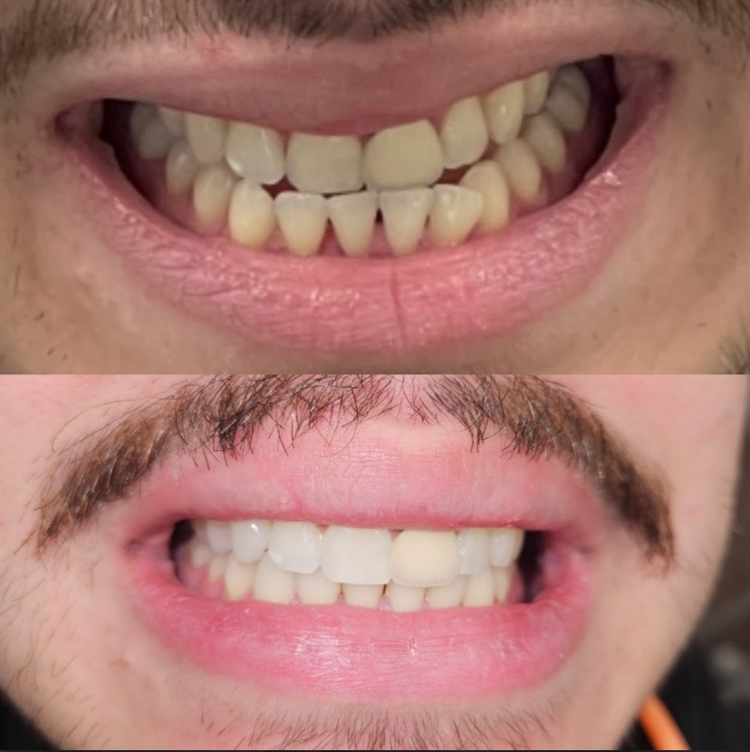 Smile transformation