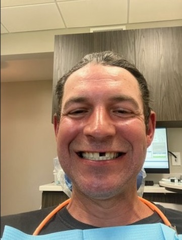 Before dental transformation